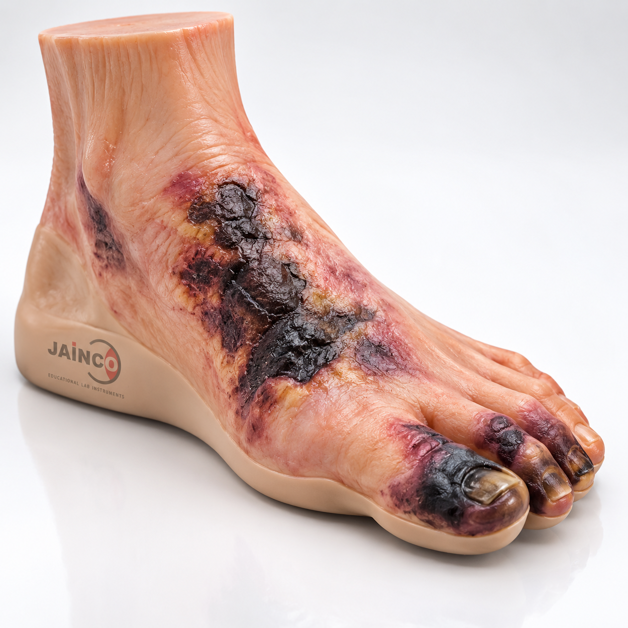 Mucor Mycosis of Foot Model
